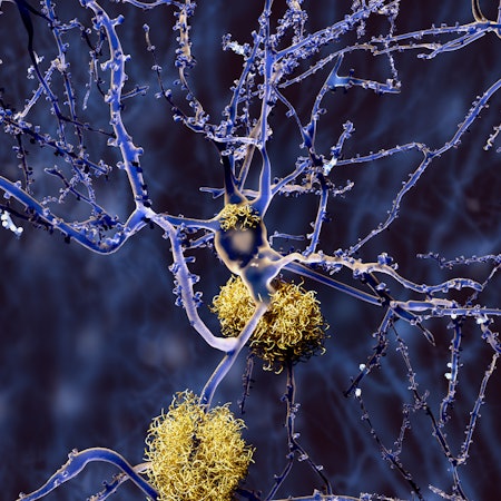 Alzheimer Symbol DPA 040122