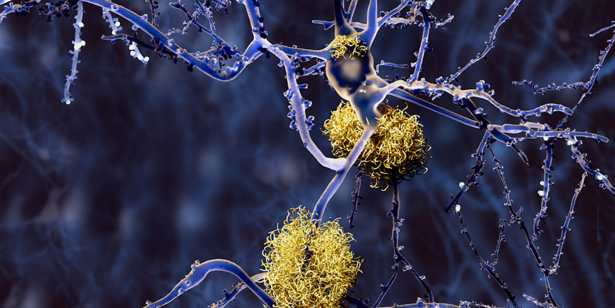 Alzheimer Symbol DPA 040122