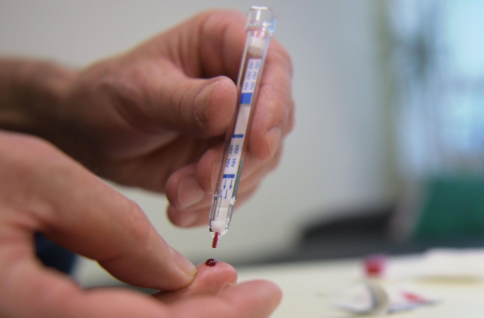 HIV Selbsttest