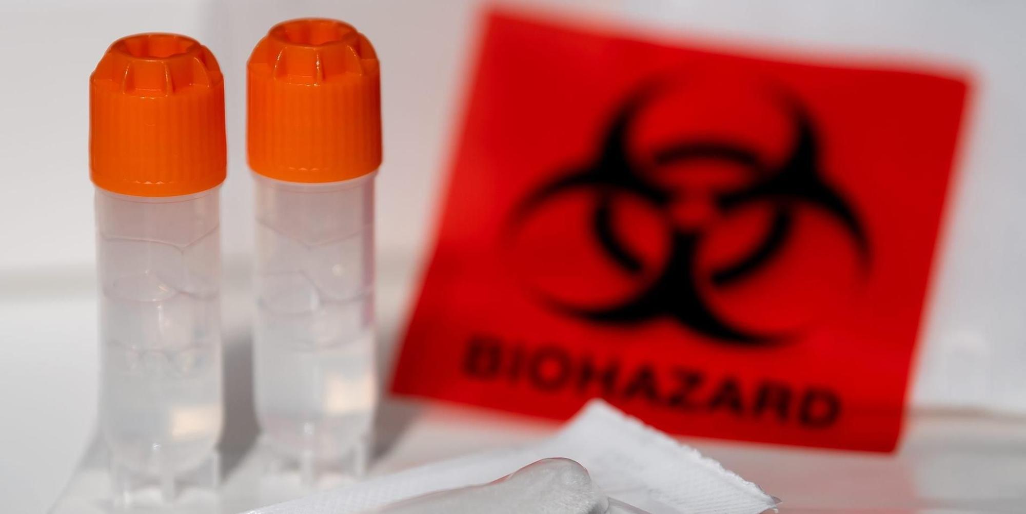 Ahnenforschung DNA-Analyse