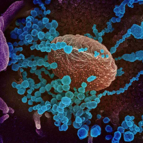 20200303coronavirus-005