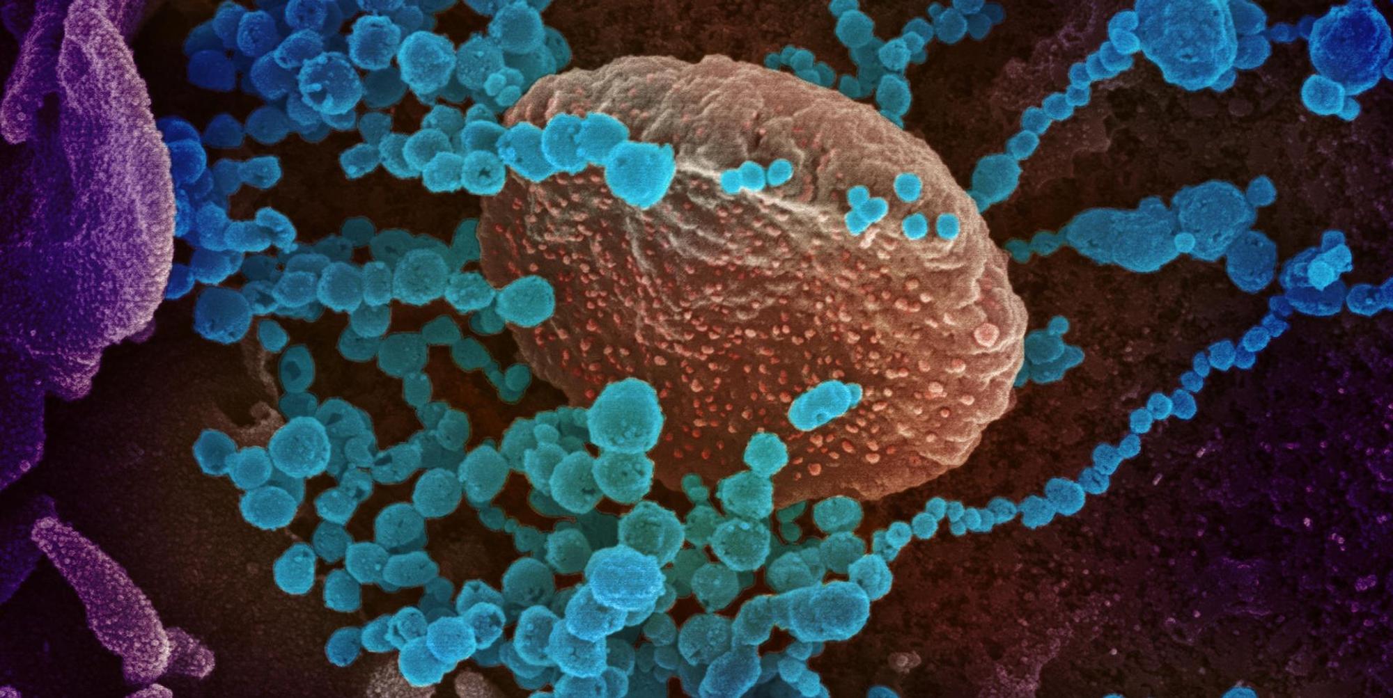 20200303coronavirus-005