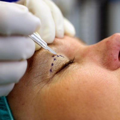 Schoenheits_OP_46844815