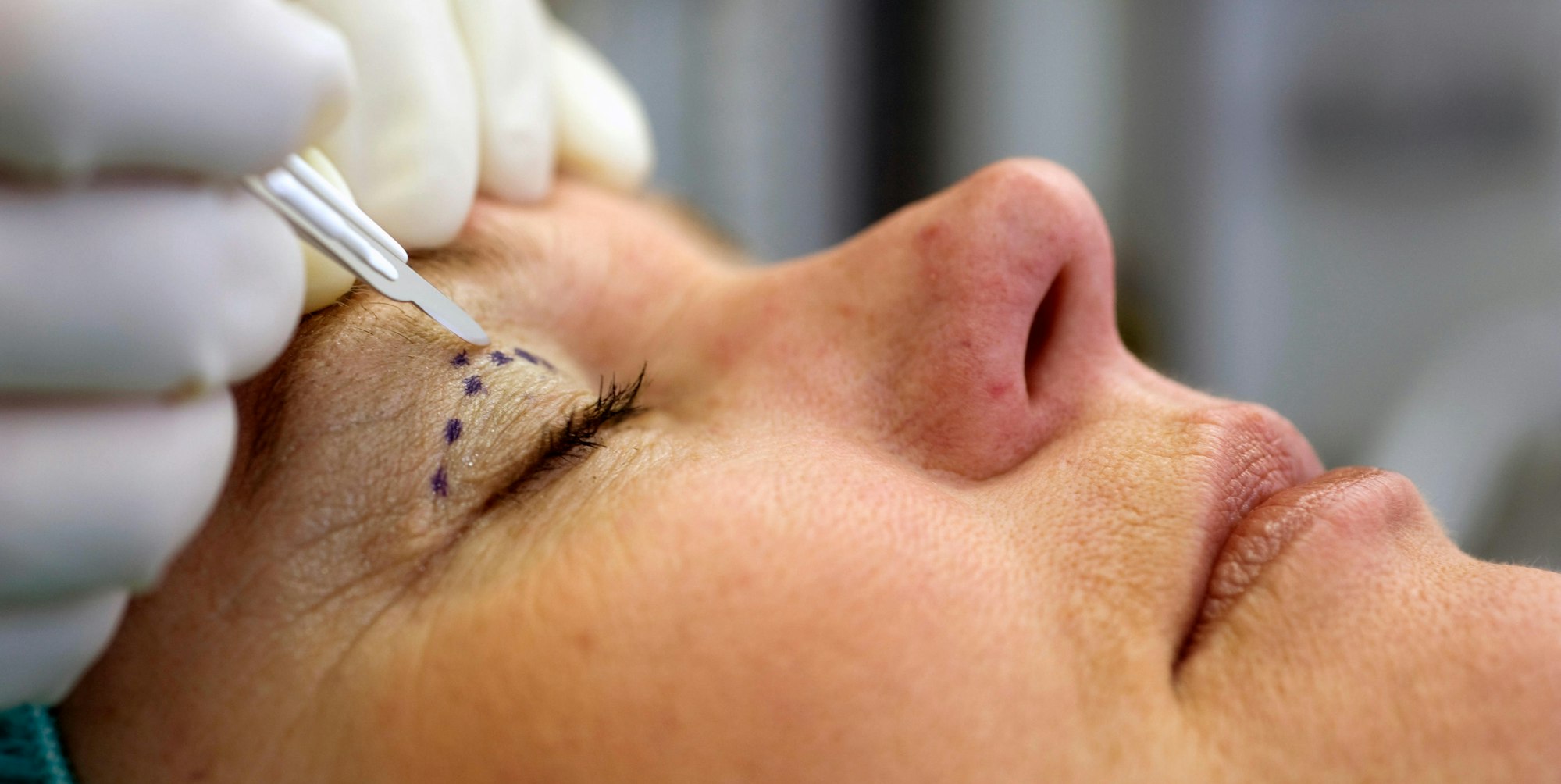 Schoenheits_OP_46844815